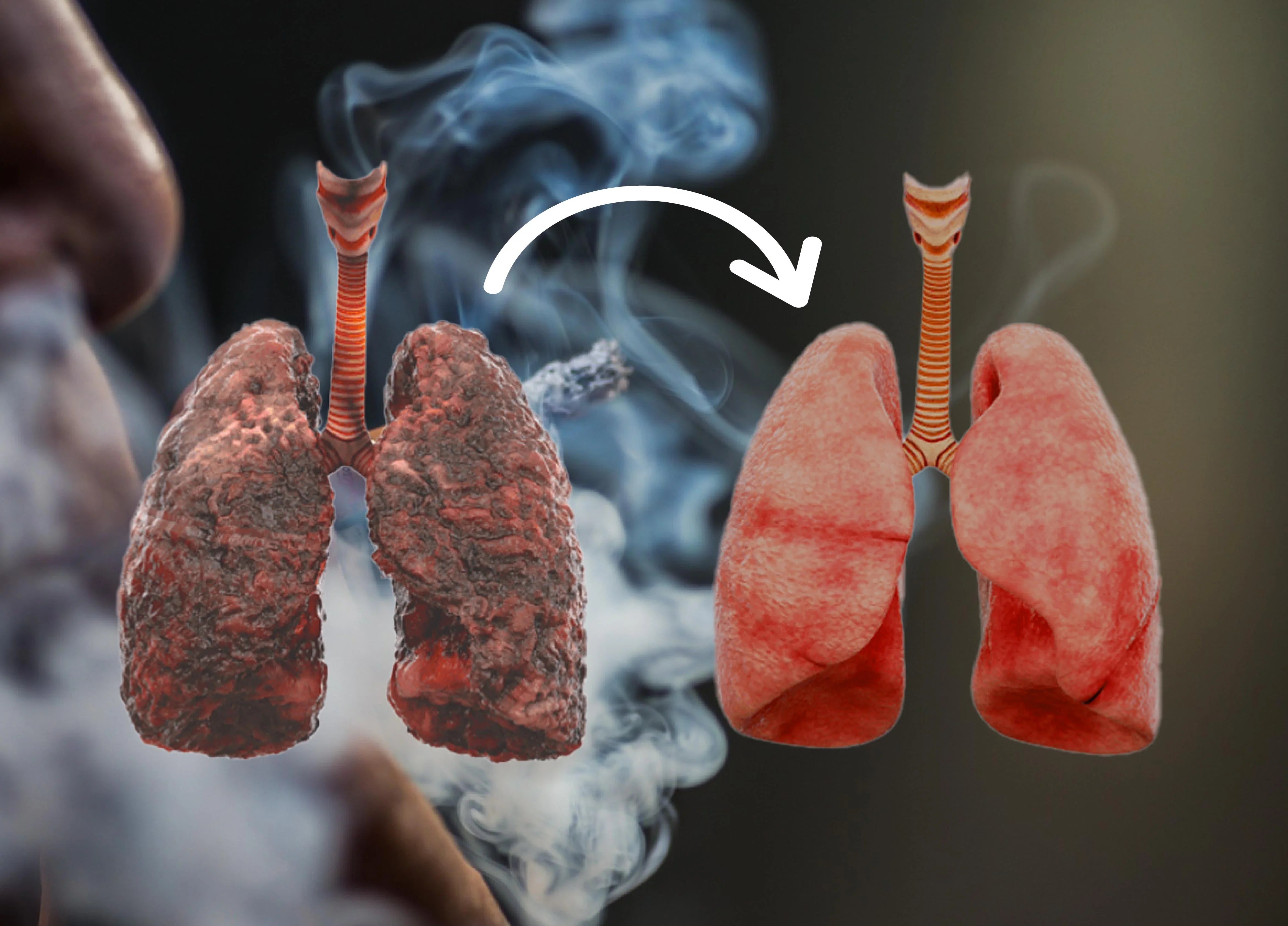Comparación de pulmones: congestionados frente a despejados